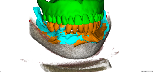 stackable-Fall mit Dr. Jan Spieckermann